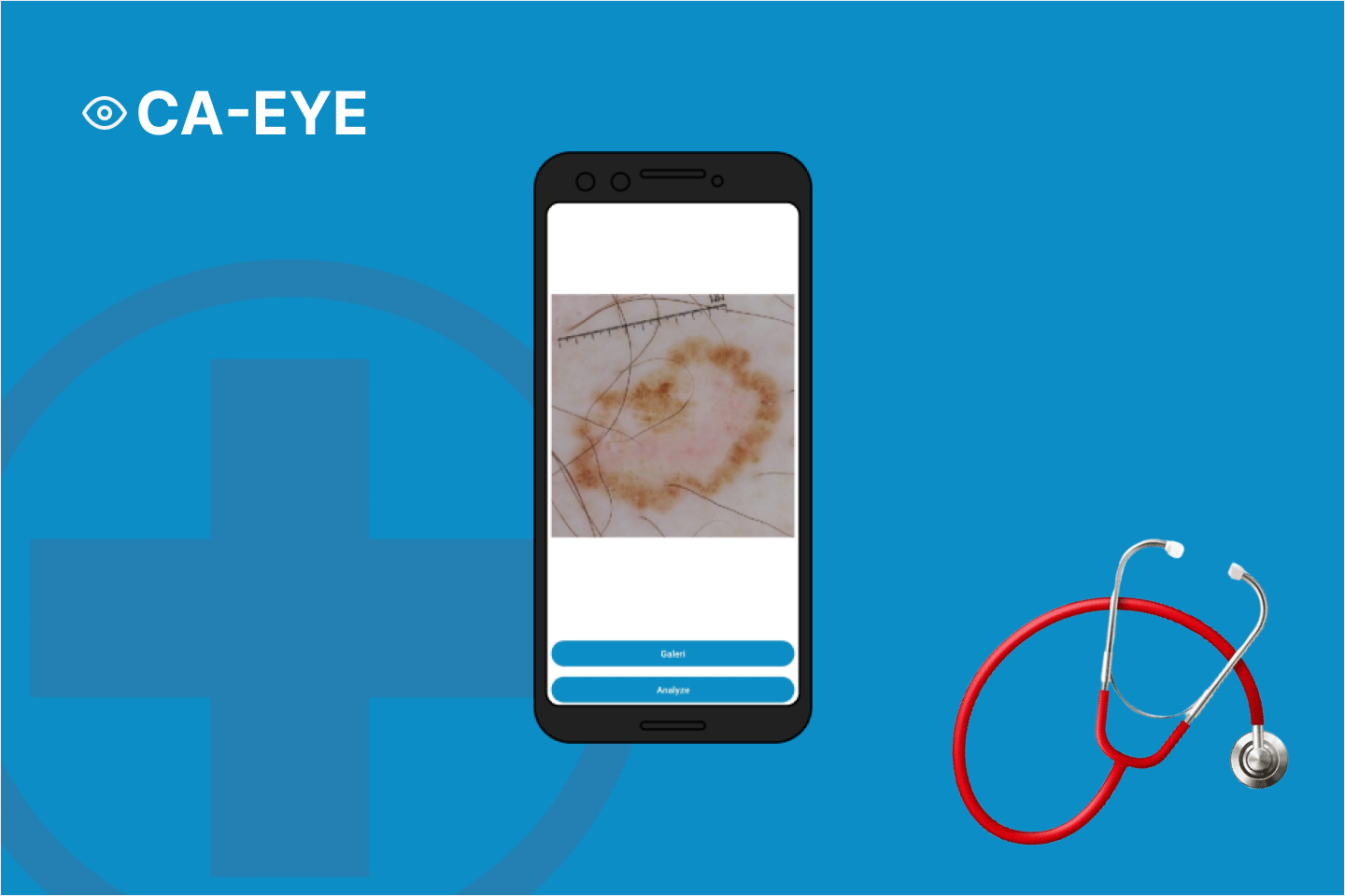 aplikasi CA-Eye, aplikasi analisa kanker berbasis android oleh Luqmanul Hakiem
